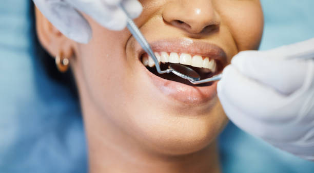 Best Emergency Dental Care for Sports Injuries in Mebane, NC