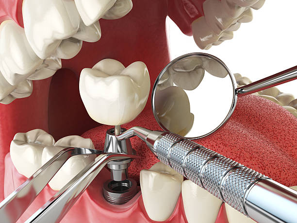Best Emergency Treatment for Oral Infections in Mebane, NC
